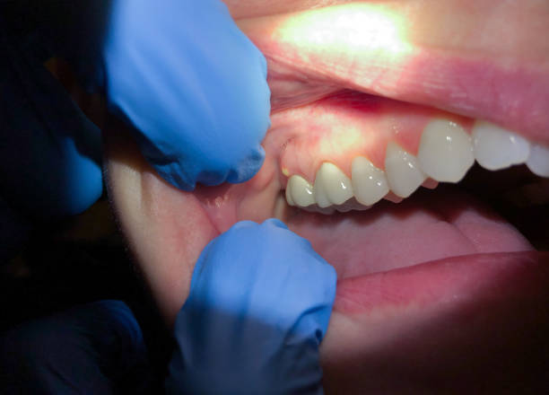 Best Broken Tooth Emergency  in Lakeland, GA